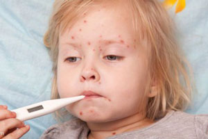 toptoop.irچه واکسن هایی برای کودکان ضروری هستند