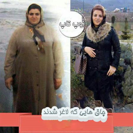 toptoop.irعکس زنان چاق ایرانی که لاغر شدند