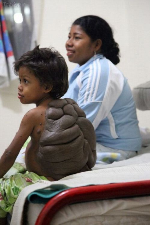 پسر لاکپشتی در کلمبیا