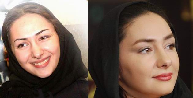 عکس بازیگران قبل و بعد از عمل جراحی