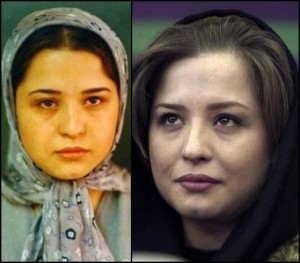 بازیگران ایرانی قبل و بعد عمل