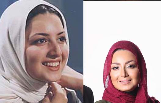 چهره بازیگران ایرانی قبل و بعد عمل